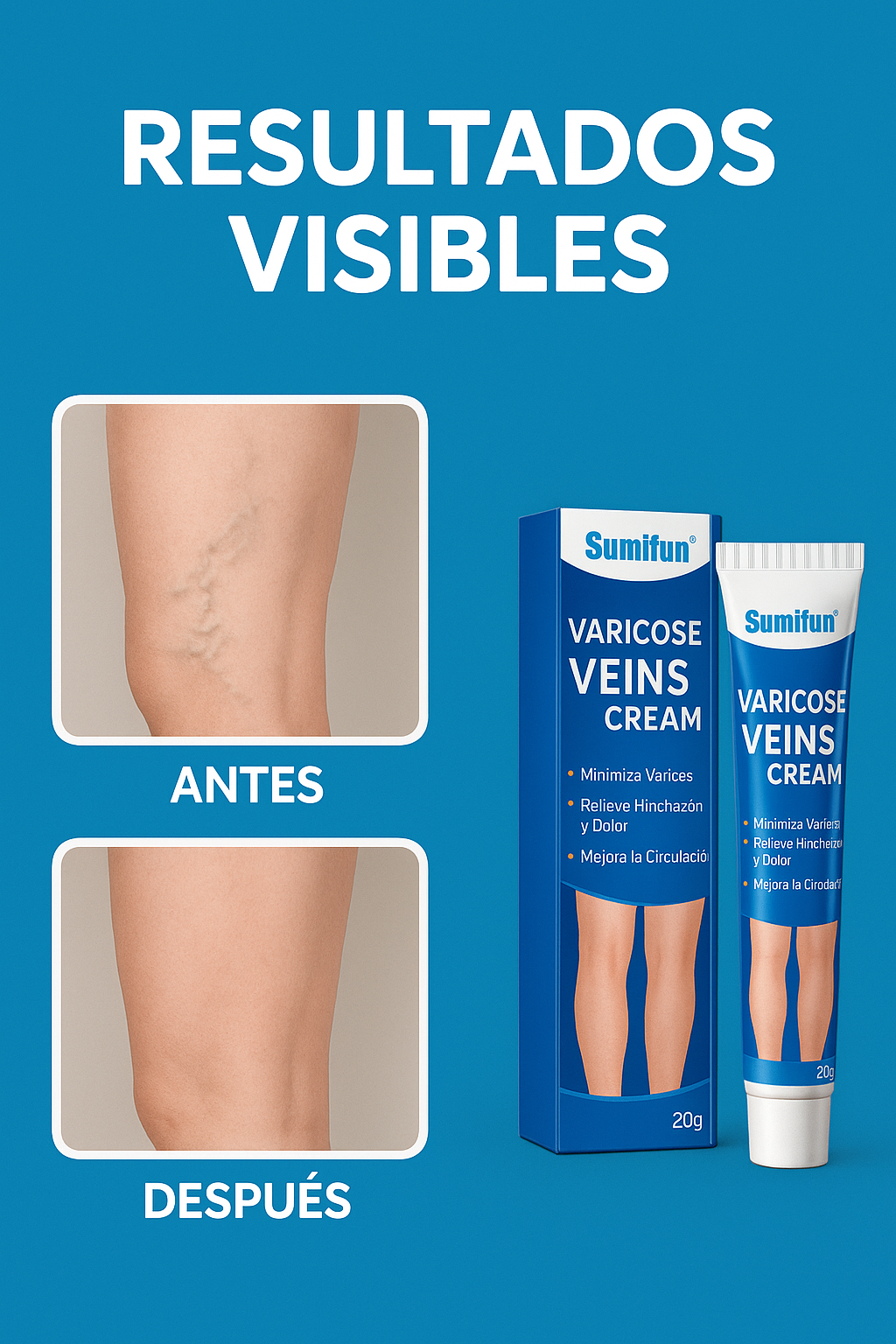 Crema Para Varices